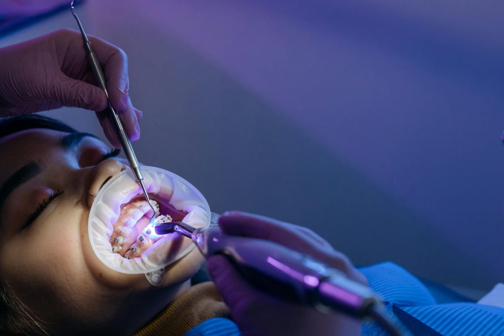 Oral Hygiene Dentist Pretoria